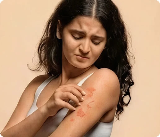 Fast Relief for Intense Fungal Itching