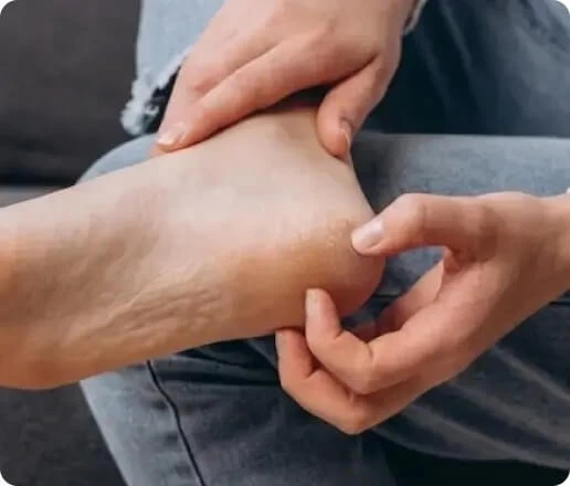 How to Manage Stubborn Fungal Infections