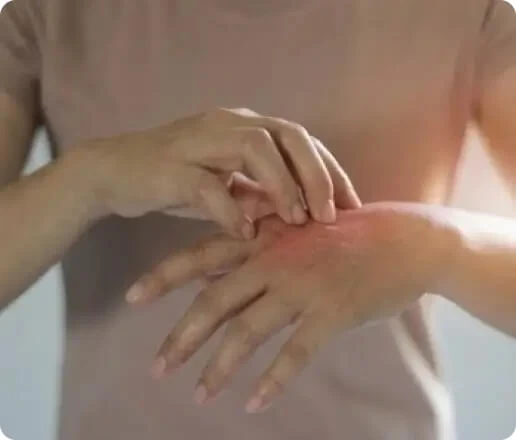 The Hidden Danger of Scratching a Fungal Rash