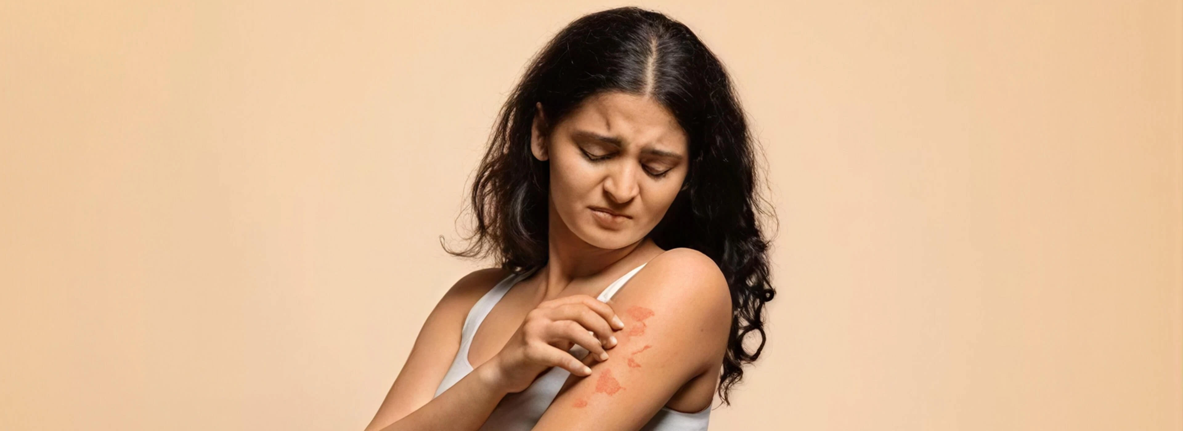 Fast Relief for Intense Fungal Itching