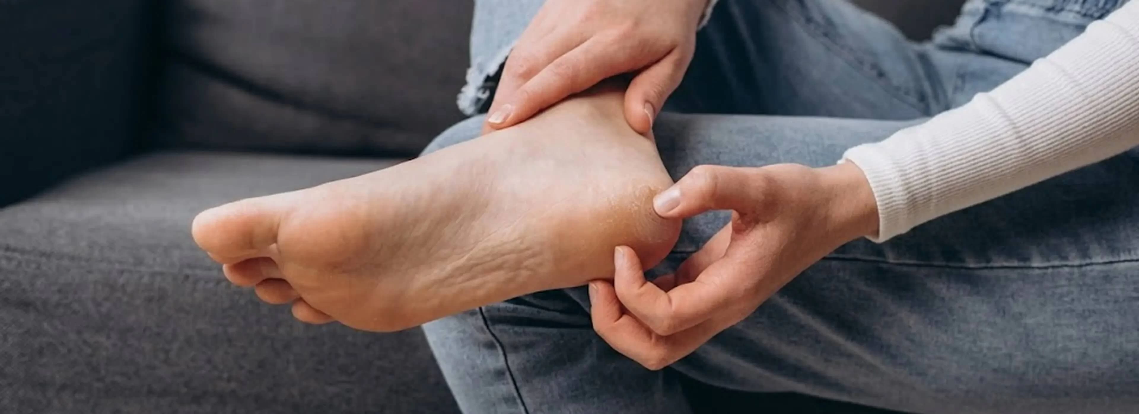 How to Manage Stubborn Fungal Infections