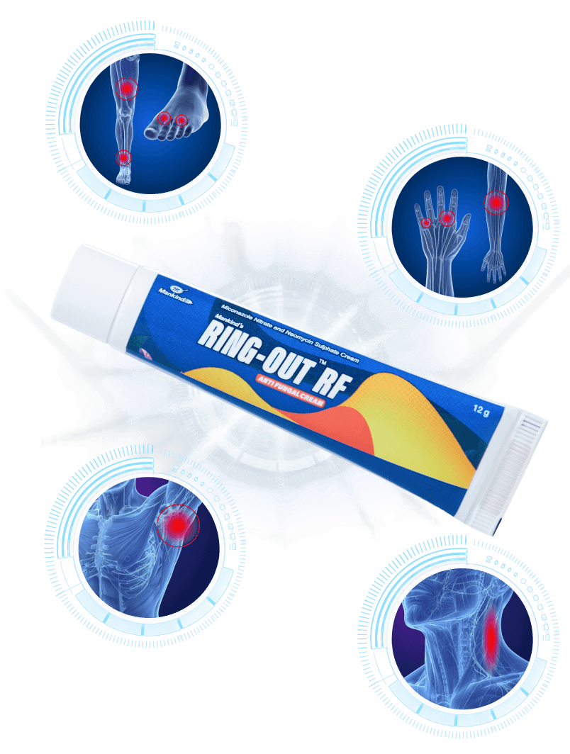 Ring Out RF Antifungal Cream